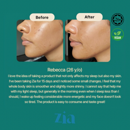 Zia Sleep Whitening Vegan Plant Based Collagen Drink (Japan Formulated)